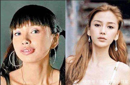 整容对比照片,整容前后对比，见证美丽蜕变之旅